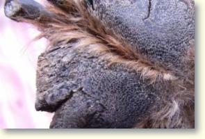 Hipercheratoza 