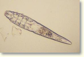 Demodex